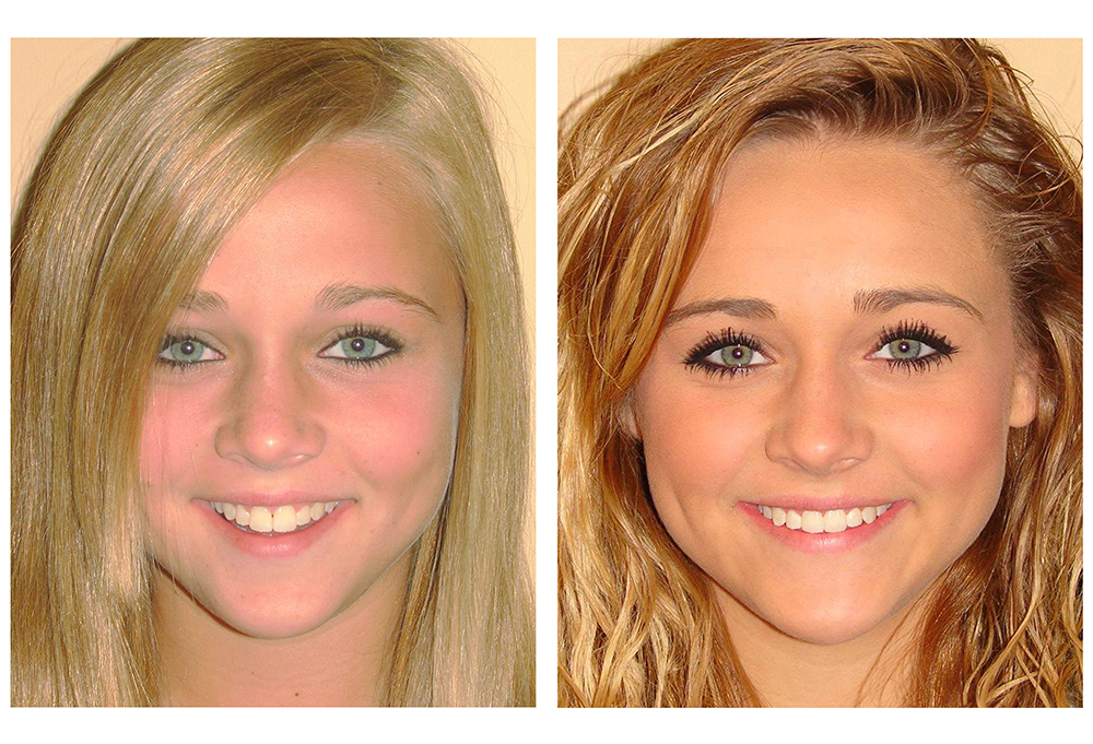 Attentive Dental Care of Morristown, NJ