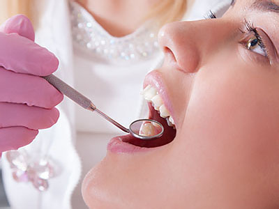 A dental hygienist using a drill on a patient s teeth during a dental procedure.